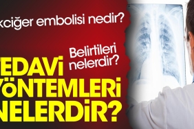 akciger-embolisi-nedir-belirtileri-nelerdir-tedavi-formulleri-nelerdir-3cNCY4Jj.jpg