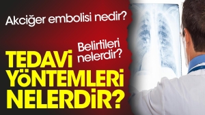 akciger-embolisi-nedir-belirtileri-nelerdir-tedavi-formulleri-nelerdir-3cNCY4Jj.jpg