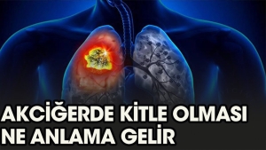 akcigerde-kitle-olmasi-nedir-7j24Iwys.jpg