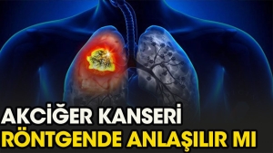 akcigerde-kitle-olmasi-nedir-pxHEntsn.jpg