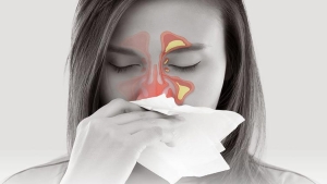 alerjik-rinit-nedir-alerjik-rinit-belirtileri-neler-6hbRgAvw.jpg