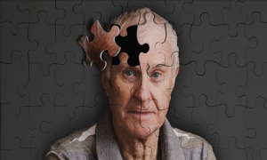 alzheimer-hastaligi-nedir-ulnMgneU.jpg