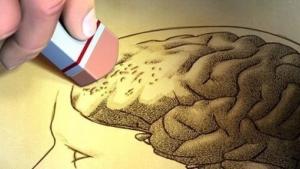 alzheimer-pvTPsqfx.jpg