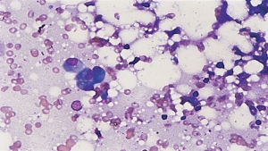 antimetabolitler-nedir-52VNluSy.jpg