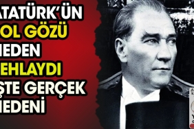 ataturkun-sol-gozu-neden-sehlaydi-UJfpTRzU.jpg