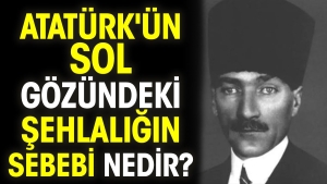 ataturkun-sol-gozundeki-sehlaligin-sebebi-nedir-fKLYERUF.jpg