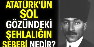 ataturkun-sol-gozundeki-sehlaligin-sebebi-nedir-fKLYERUF.jpg