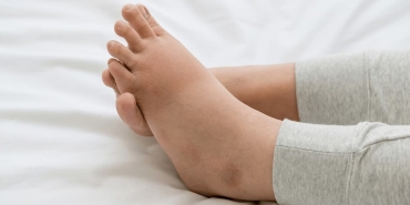 ayak-sismesi-neden-olur-nasil-gecer-DeETgOBI.jpg