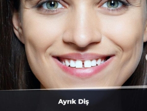 ayrik-dis-nedir-BiJr13yz.jpg
