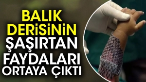 balik-derisinin-sasirtan-yararlari-ortaya-cikti-U4TGfaLz.jpg