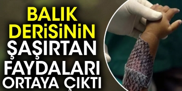 balik-derisinin-sasirtan-yararlari-ortaya-cikti-U4TGfaLz.jpg