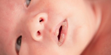 bebeklerde-dudak-kurumasi-neden-olur-bebeklerde-dudak-kuruluguna-ne-guzel-gelir-vCOdI1ut.jpg