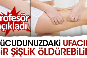 bedeninizdeki-ufacik-bir-sislik-oldurebilir-profesor-acikladi-WT1GdUlH.jpg