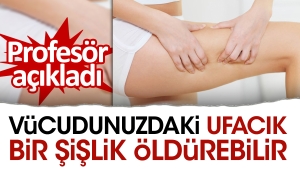 bedeninizdeki-ufacik-bir-sislik-oldurebilir-profesor-acikladi-WT1GdUlH.jpg