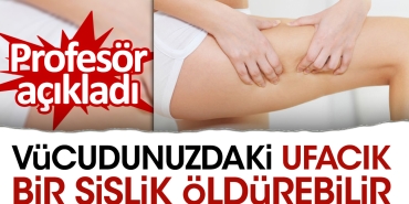 bedeninizdeki-ufacik-bir-sislik-oldurebilir-profesor-acikladi-WT1GdUlH.jpg