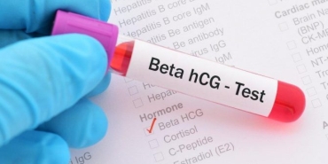 bir-haftalik-gebelikte-beta-hcg-bedeli-kac-olmali-uujzG2zu.jpg