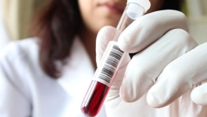 brca-gen-testi-nedir-gXnYUpMU.jpg