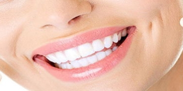 cerec-uygulamasi-nedir-estetik-gulus-tasarimi-cerec-yardimiyla-nasil-yapilir-RVcXbMkf.jpg