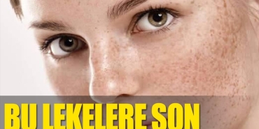 cilt-lekelerine-son-vWmz3Y1D.jpg