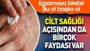 cilt-sihhati-acisindan-da-bircok-yarari-var-egzamaya-birebir-bu-ot-obur-ot-grSzhvy6.jpg