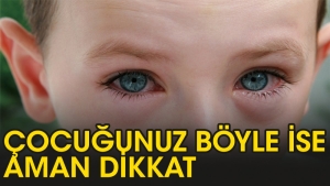 cocuklarin-gozleri-neden-kizarir-p1M8IOGX.jpg