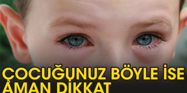 cocuklarin-gozleri-neden-kizarir-p1M8IOGX.jpg