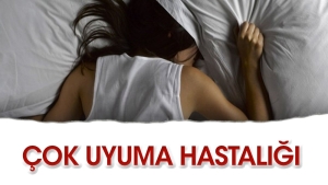 cok-ahenge-hastaligi-SmptWWWV.jpg