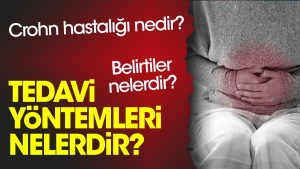 crohn-hastaligi-nedir-belirtileri-nelerdir-tedavi-usulleri-nelerdir-hPuMg6Bm.jpg