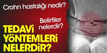 crohn-hastaligi-nedir-belirtileri-nelerdir-tedavi-usulleri-nelerdir-hPuMg6Bm.jpg