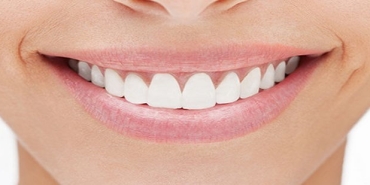 dental-plak-ve-dis-tasi-nedir-nasil-giderilir-mSnqvQQl.jpg