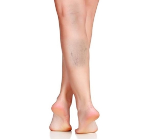 derin-ven-trombozu-dvt-nedir-D5kjHCzd.jpg
