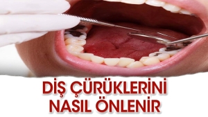 dis-curukleri-nasil-onlenir-p2Vb7aXe.jpg