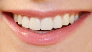 dis-eti-hastaliklari-periodontoloji-nedir-KJax2yBu.jpg
