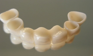 dis-protezi-nedir-hBCX4c7u.jpg