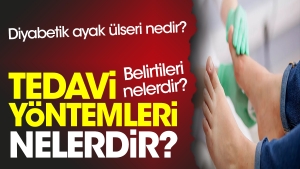 diyabetik-ayak-ulseri-nedir-belirtileri-nelerdir-tedavi-metotlari-nelerdir-UQAM8urg.jpg