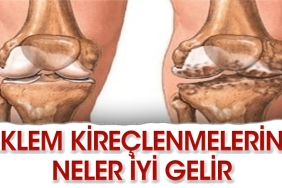 diz-kireclenmelerine-en-guzel-ne-gelir-wvvbltj1.jpg
