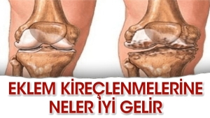 diz-kireclenmelerine-en-guzel-ne-gelir-wvvbltj1.jpg