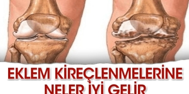 diz-kireclenmelerine-en-guzel-ne-gelir-wvvbltj1.jpg