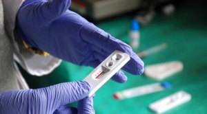 dunyada-azaliyor-turkiyede-artiyor-25-bin-sahista-hiv-virusu-var-FvCDwl1J.jpg