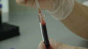 dusuk-tansiyon-yuksek-ates-filiz-akini-hastanelik-eden-sepsis-belirtileri-UprNEsxb.jpg