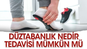 duztabanligin-tedavisi-mumkun-mu-iMdYiPk5.jpg