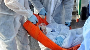 ebola-nedir-belirtileri-nelerdir-ebola-virusu-tedavisi-var-mi-zWcYAdJt.jpg