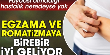 egzama-ve-romatizmaya-birebir-l-geliyor-yarari-olmadigi-hastalik-neredeyse-yok-1AxWE1IG.jpg