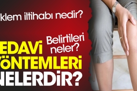 eklem-iltihabi-nedir-belirtileri-neler-tedavi-sistemleri-nelerdir-2gPiKmFX.jpg