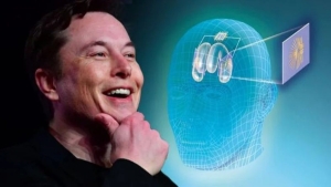 elon-muskin-cilgin-projesi-neuralink-nedir-iste-neuralink-hakkinda-bilmeniz-gereken-her-sey-MkMfMeSV.jpg