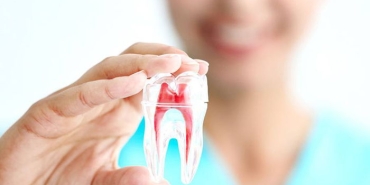 endodonti-nedir-J23AWmw7.jpg