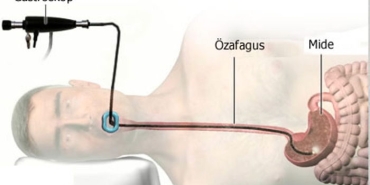 endoskopi-ve-gastroskopi-nedir-cuAhFJhd.jpg