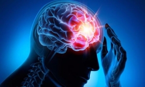 epilepsi-nedir-NqwiY6Db.jpg