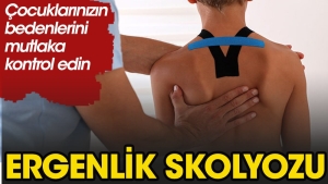 ergenlik-skolyozunda-anne-babalar-nelere-dikkat-etmeli-9NLAHMfn.jpg