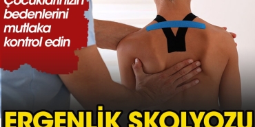 ergenlik-skolyozunda-anne-babalar-nelere-dikkat-etmeli-9NLAHMfn.jpg